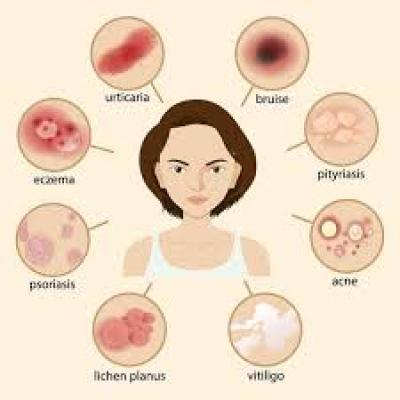 Skin Infection